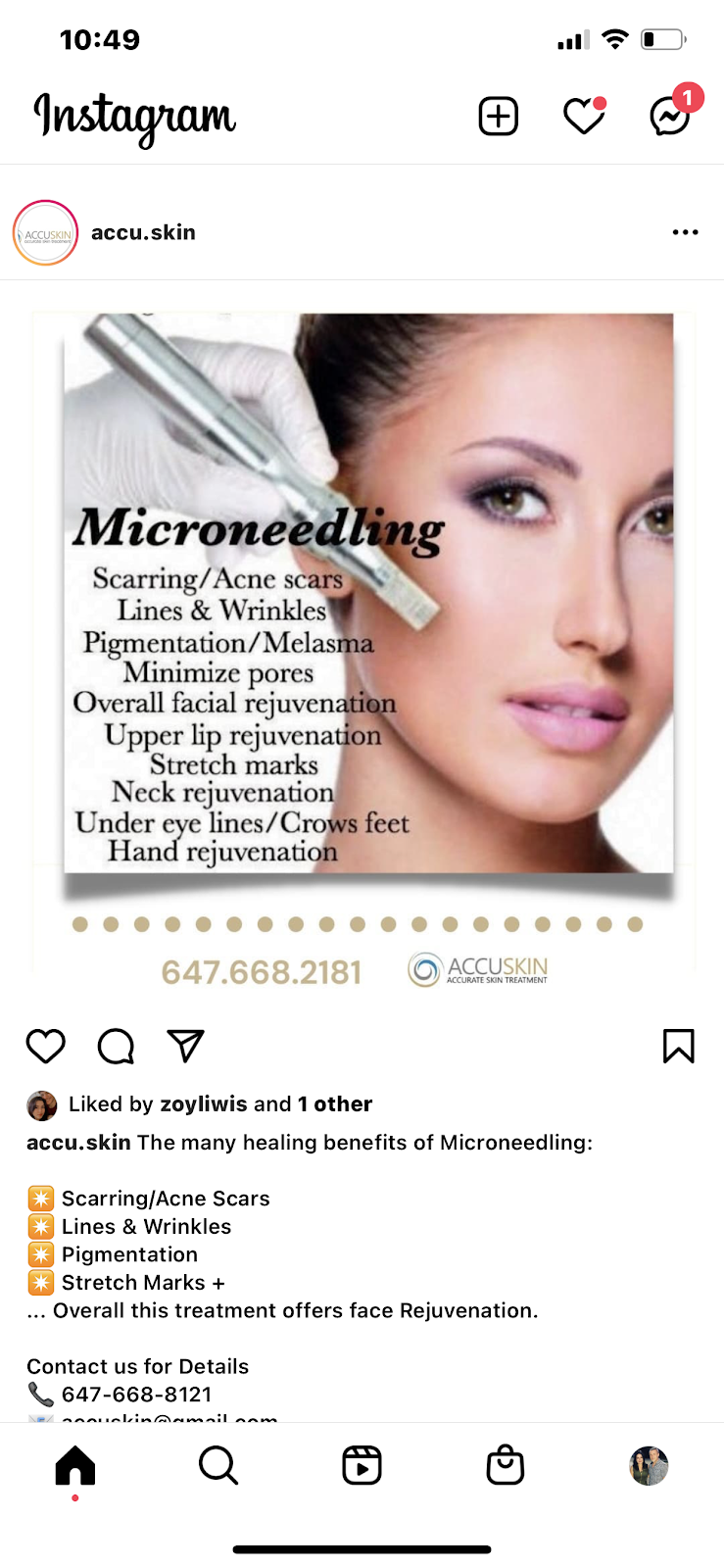 Accuskin | 51 Mynden Way, Newmarket, ON L3X 3A8, Canada | Phone: (647) 668-8121