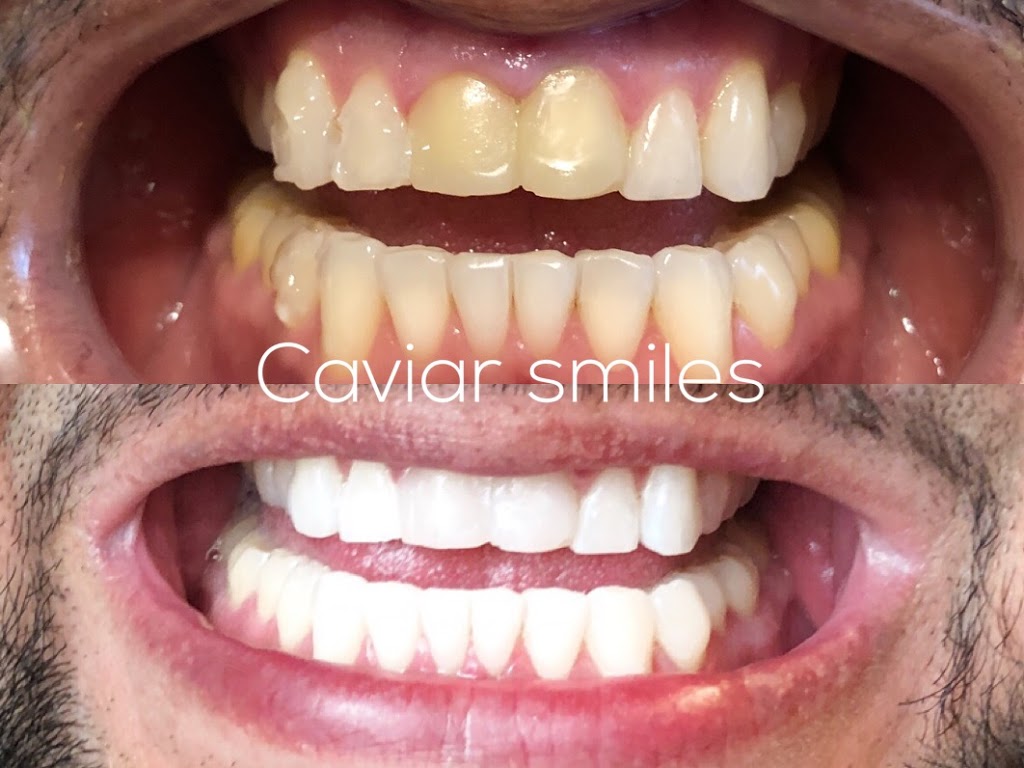 Caviar Smiles | 66 Walpole Ave #103, Toronto, ON M4L 3W5, Canada | Phone: (437) 220-9338