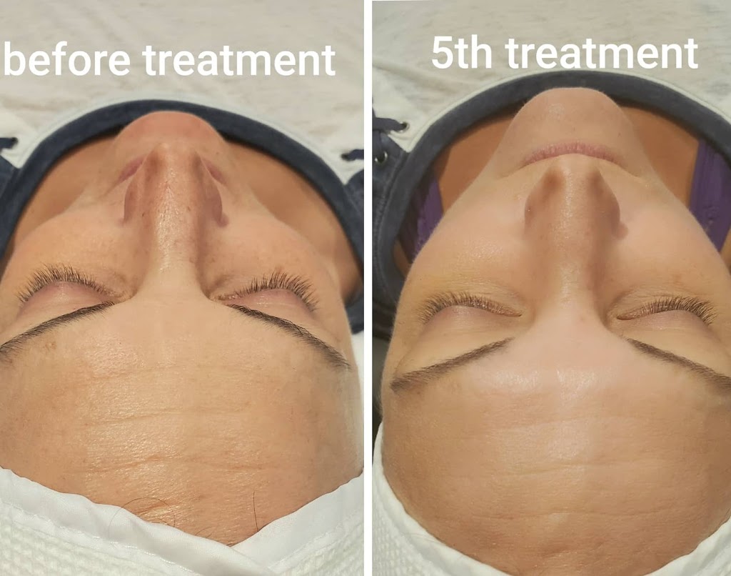 The New You Beauty Studio | 120 Glenroy Crescent, London, ON N5Z 4H7, Canada | Phone: (519) 630-5544