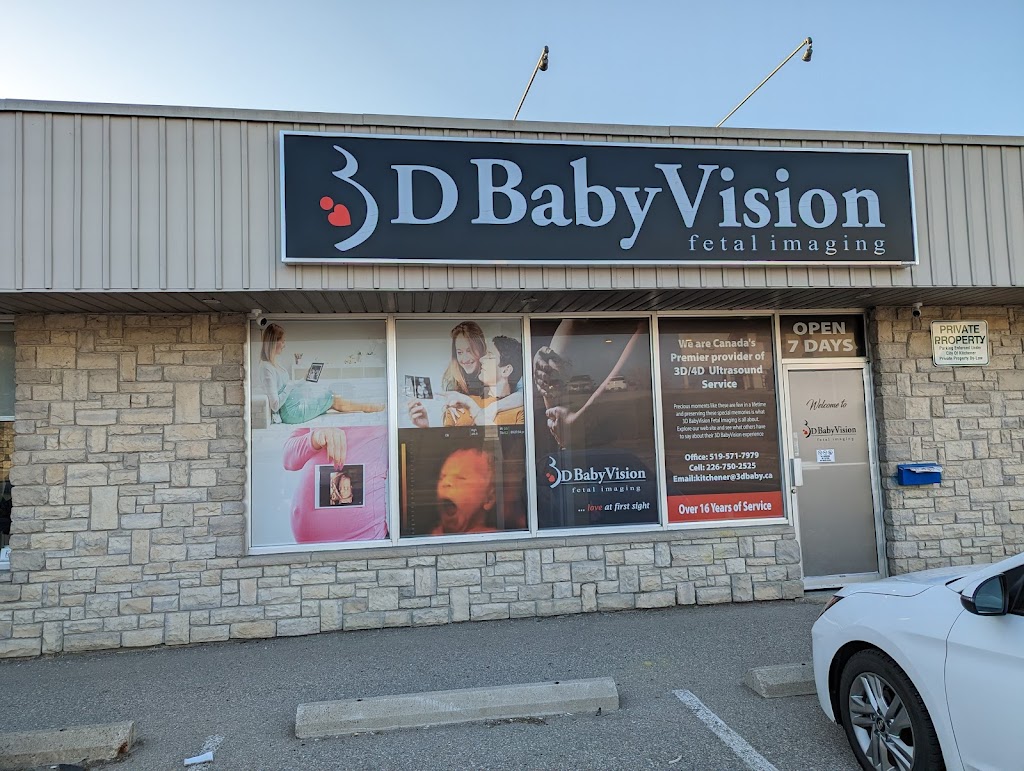 3D/4D BabyVision Ultrasound Kitchener | 591 Lancaster St W, Kitchener, ON N2K 1M5, Canada | Phone: (519) 571-7979