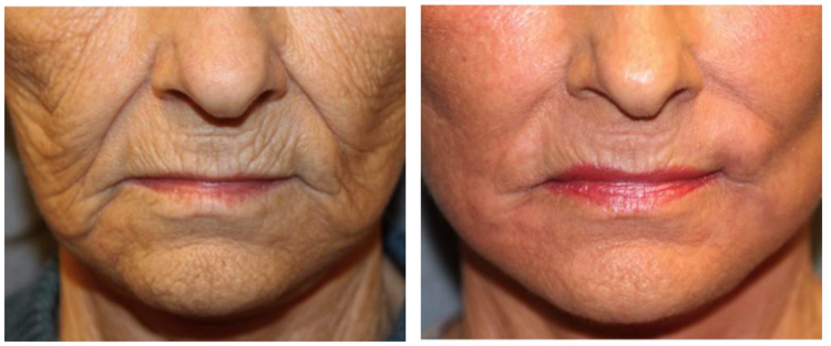 Radiance By Vanesa | 306 Prestwick Landing SE, Calgary, AB T2Z 3W2, Canada | Phone: (403) 850-0503