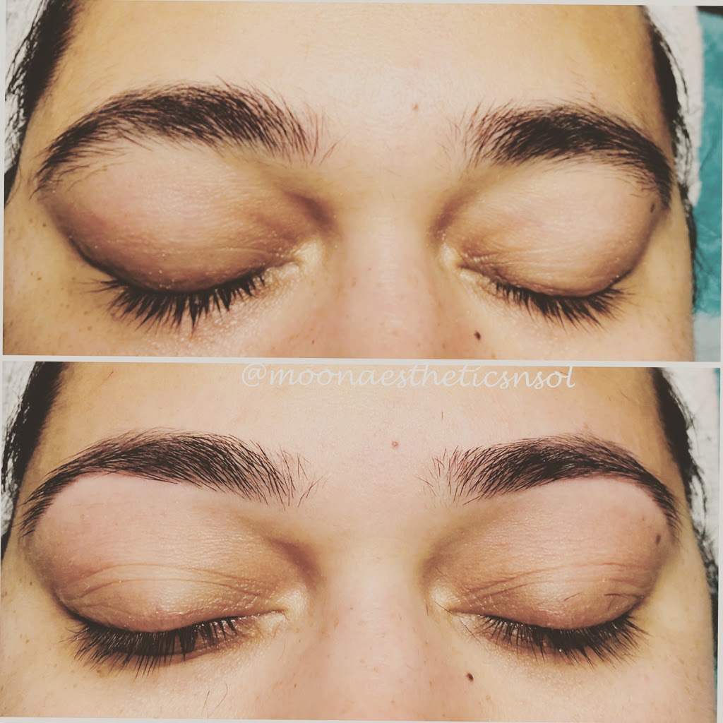 Moon Aesthetics n Solutions | 159 Shephard Ave, Alliston, ON L9R 0J8, Canada | Phone: (705) 718-1836
