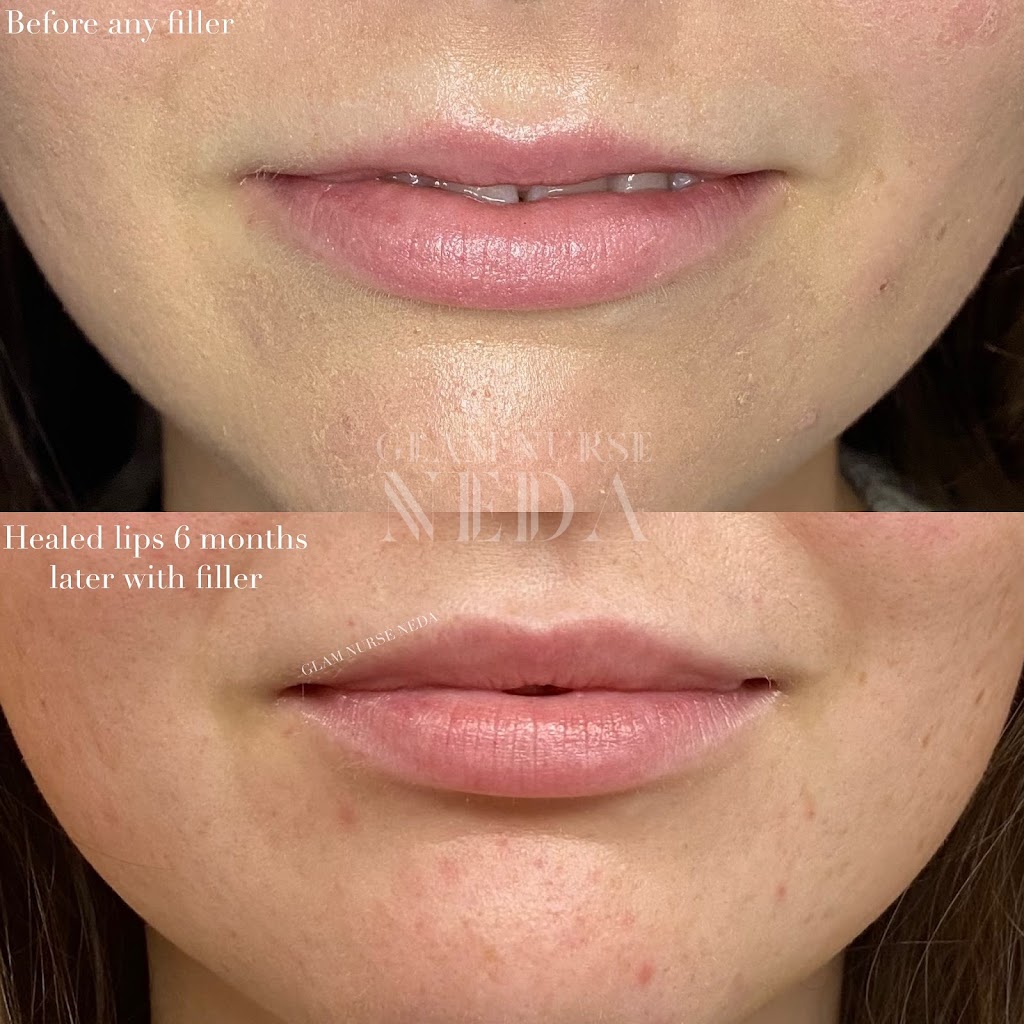 Bespoke Medical Aesthetics | 446 Winston Rd, Grimsby, ON L3M 0H2, Canada | Phone: (289) 442-1419