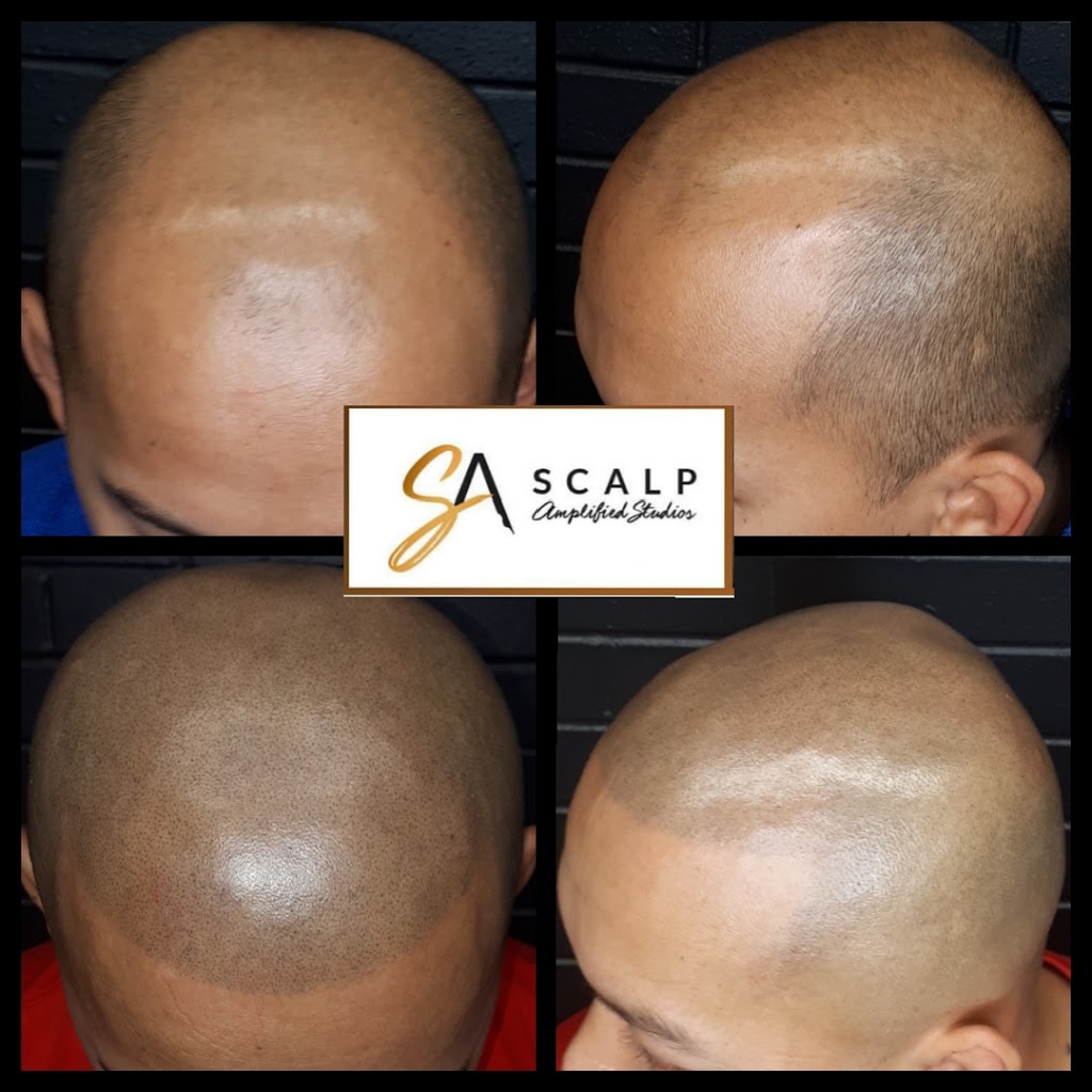 Scalp Amplified Studios | 987 King St E Unit 205, Hamilton, ON L8M 1C6, Canada | Phone: (905) 929-9250