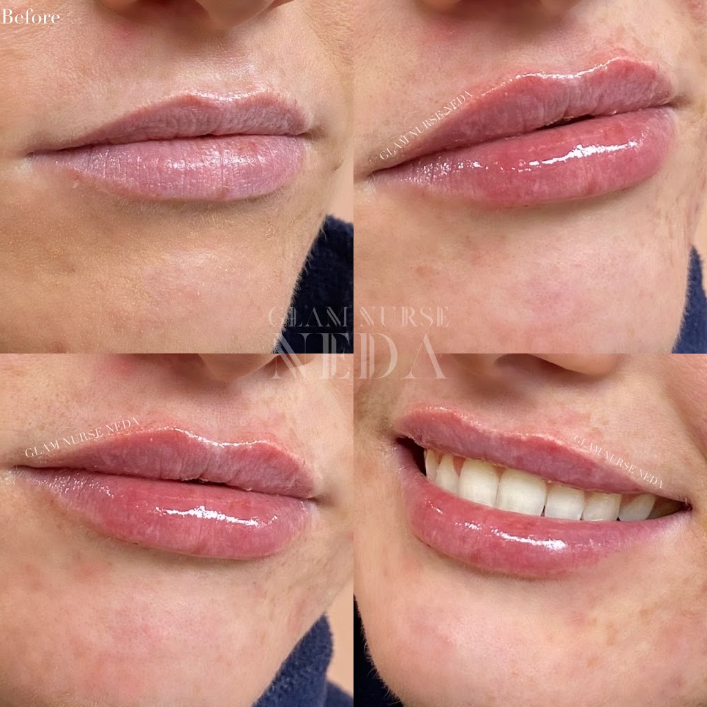 Bespoke Medical Aesthetics | 446 Winston Rd, Grimsby, ON L3M 0H2, Canada | Phone: (289) 442-1419