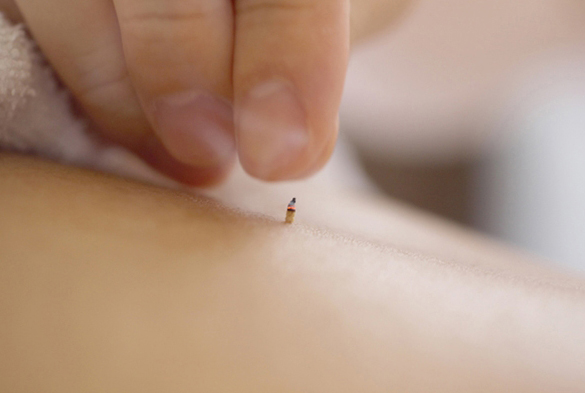 The Centre for Japanese Acupuncture | 3189 Yonge St, Toronto, ON M4N 2K9, Canada | Phone: (416) 551-2352