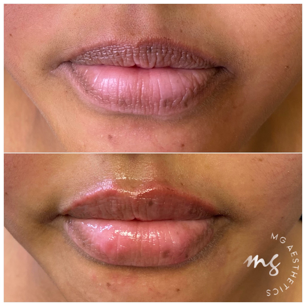 MG AESTHETICS | 10395 Weston Rd, Woodbridge, ON L4H 3T4, Canada | Phone: (289) 380-7774