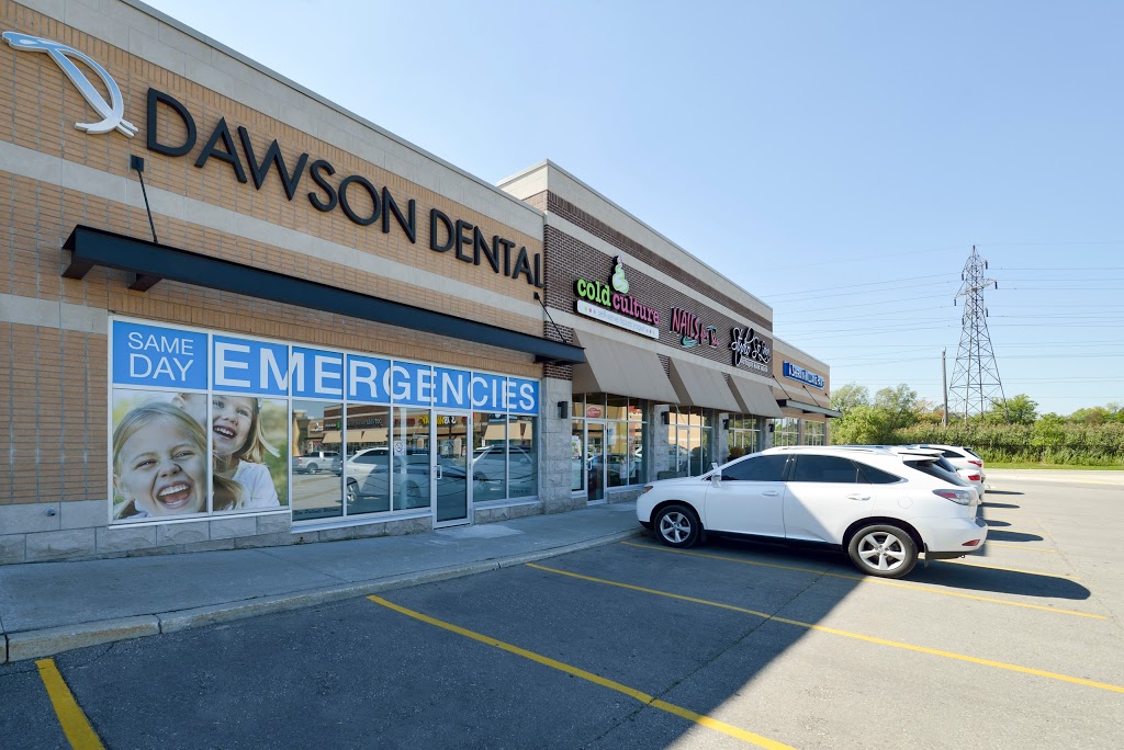 Dawson Dental Centre | 235 Ira Needles Blvd, Kitchener, ON N2N 3K6, Canada | Phone: (519) 742-2010