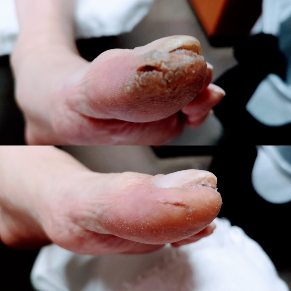 2fixfeet | 187 Lynnbrook Crescent, Waterloo, ON N2L 4X2, Canada | Phone: (519) 722-2045