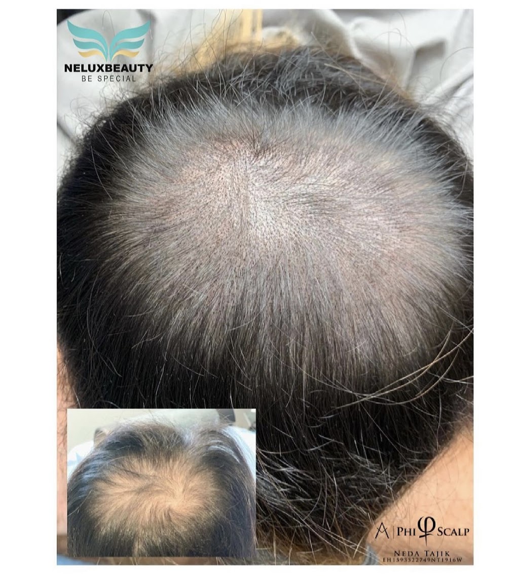Neluxbeauty | 10 Navan Crescent, Aurora, ON L4G 2V5, Canada | Phone: (647) 864-6637