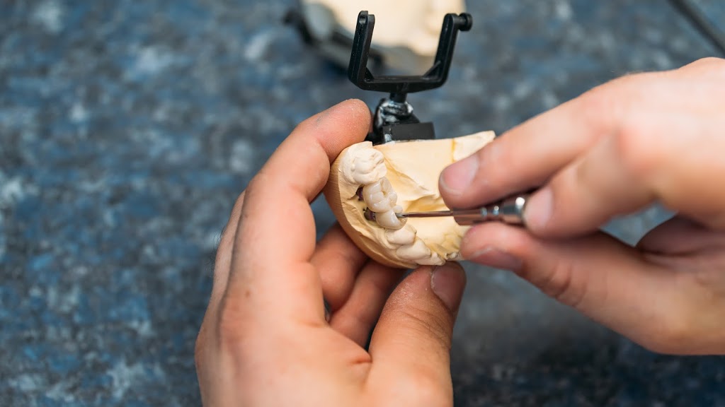 Schack Dental Ceramic Ltd | 757 K. L. O. Rd #1, Kelowna, BC V1Y 9L8, Canada | Phone: (250) 860-1727