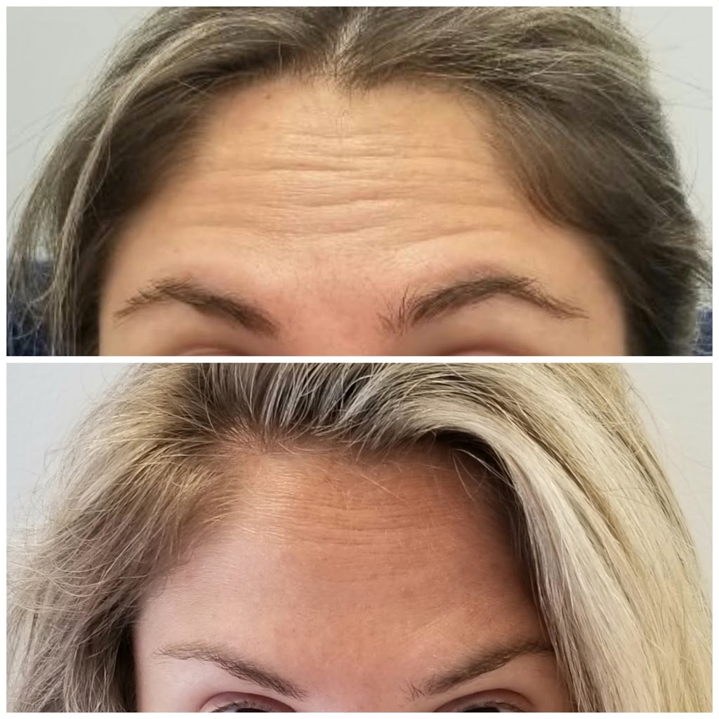 S.M.L.L Skin Solutions | 1092 Islington Ave Unit #201, Etobicoke, ON M8Z 4R9, Canada | Phone: (416) 417-2516