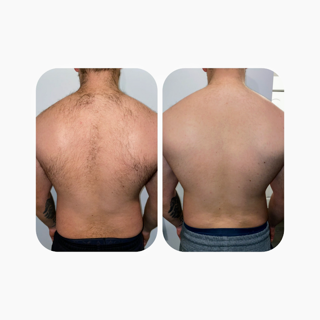 www.sequoialaserlab.ca | 47251 Brewster Pl, Chilliwack, BC V2R 5Z9, Canada | Phone: (604) 302-3197