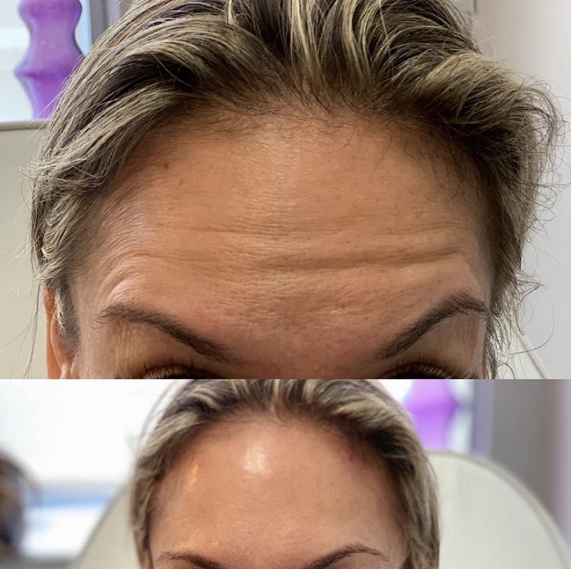 Luxe Beauté Clinic Canada - Cosmetic Dermatology | 875 Bank St, Ottawa, ON K1S 3W4, Canada | Phone: (613) 793-8987