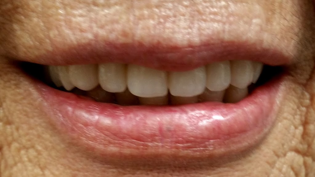 Esthetics Denture Studio Inc. | 3671 Westminster Hwy #240, Richmond, BC V7C 5W6, Canada | Phone: (604) 279-9151