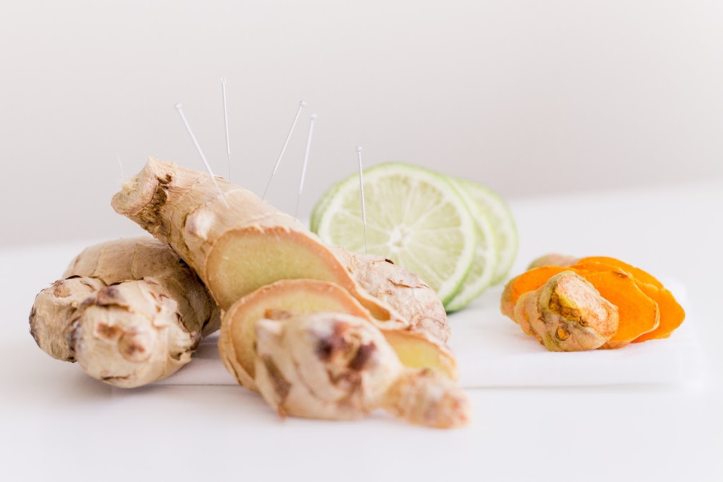 Acupuncture Charline Bet | 35 Rue Riverside, Saint-Lambert, QC J4R 1A1, Canada | Phone: (438) 888-5885