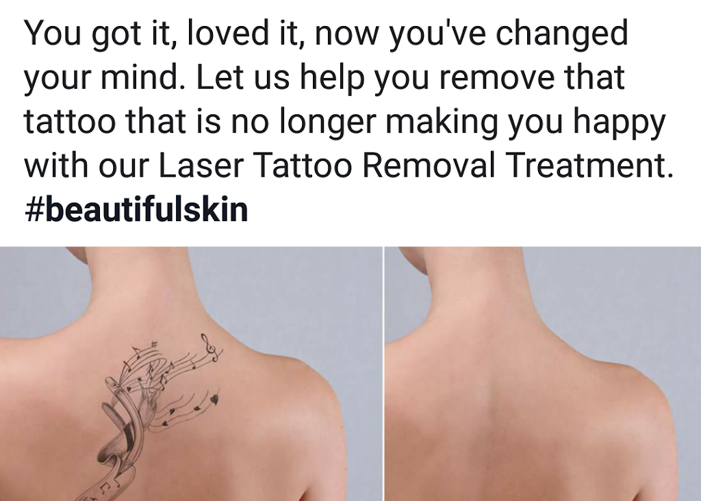 North London Electrolysis and Laser | 5 Wildflower Pl, London, ON N5Y 5M4, Canada | Phone: (519) 859-5068