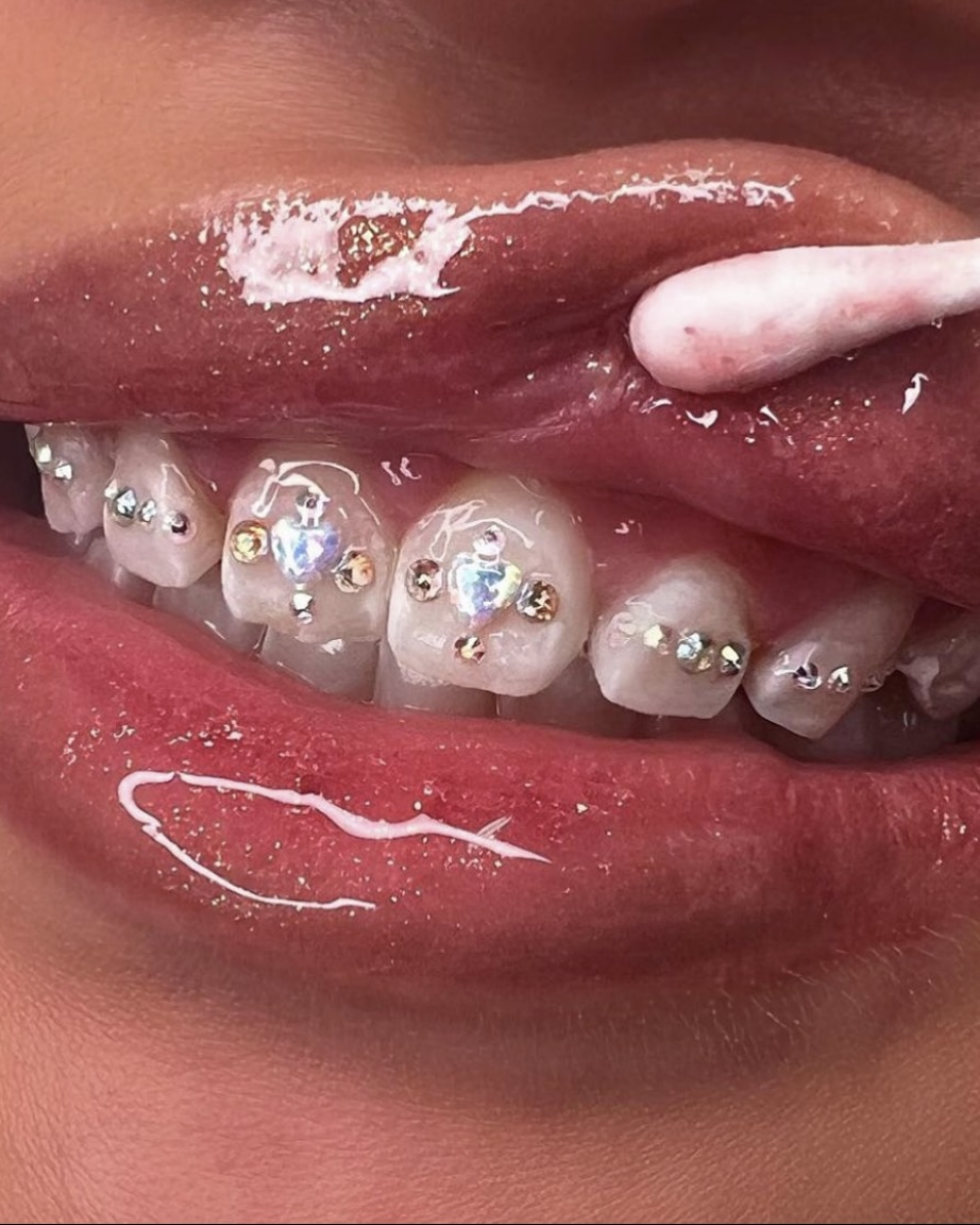 ICY TOOTHFAIRY | 1924 Windwood Pl, Orléans, ON K1C 7K7, Canada | Phone: (873) 999-6229