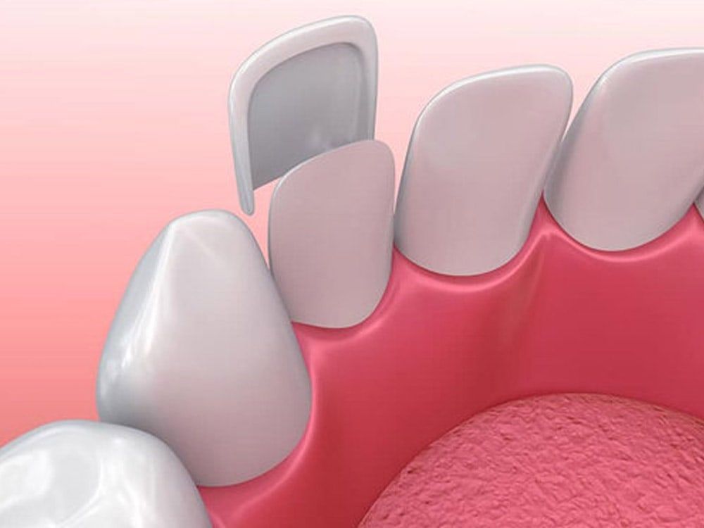 South Trail Crossing Dental | 4307 130 Ave SE #57, Calgary, AB T2Z 3V8, Canada | Phone: (403) 720-2778