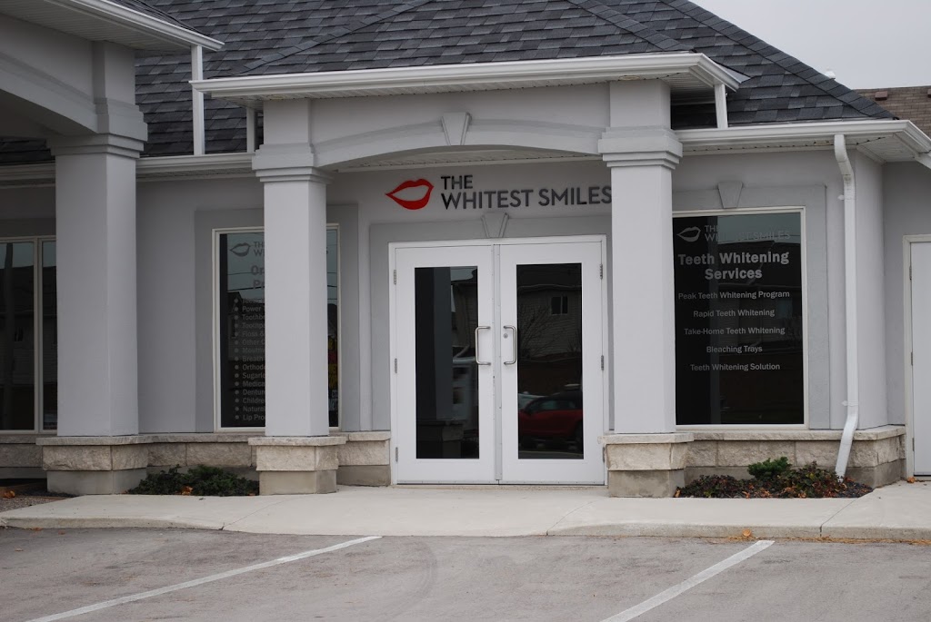 THE WHITEST SMILES Professional Teeth Whitening Centre | 251 Fanshawe Park Rd W #200, London, ON N6G 0E1, Canada | Phone: (877) 476-4534