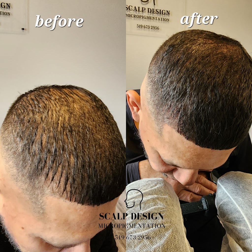 SCALP DESIGN MICROPIGMENTATION | 710 Railton Ave, London, ON N5V 4E1, Canada | Phone: (519) 673-2956