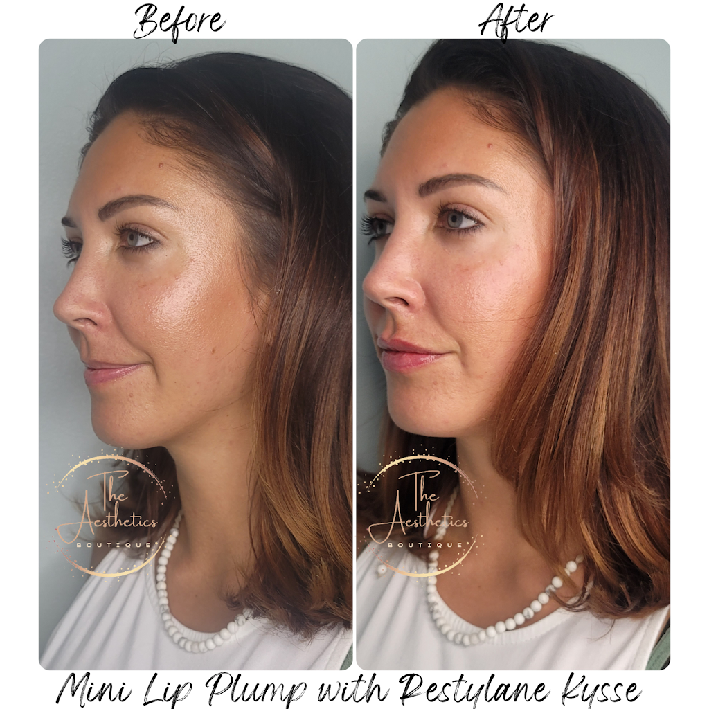The Aesthetics Boutique | 64 Viking Dr, Binbrook, ON L0R 1C0, Canada | Phone: (289) 921-8240