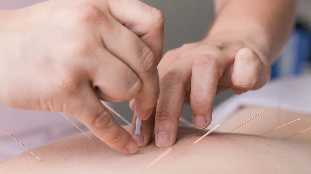 Acupuncture Charline Bet | 35 Rue Riverside, Saint-Lambert, QC J4R 1A1, Canada | Phone: (438) 888-5885