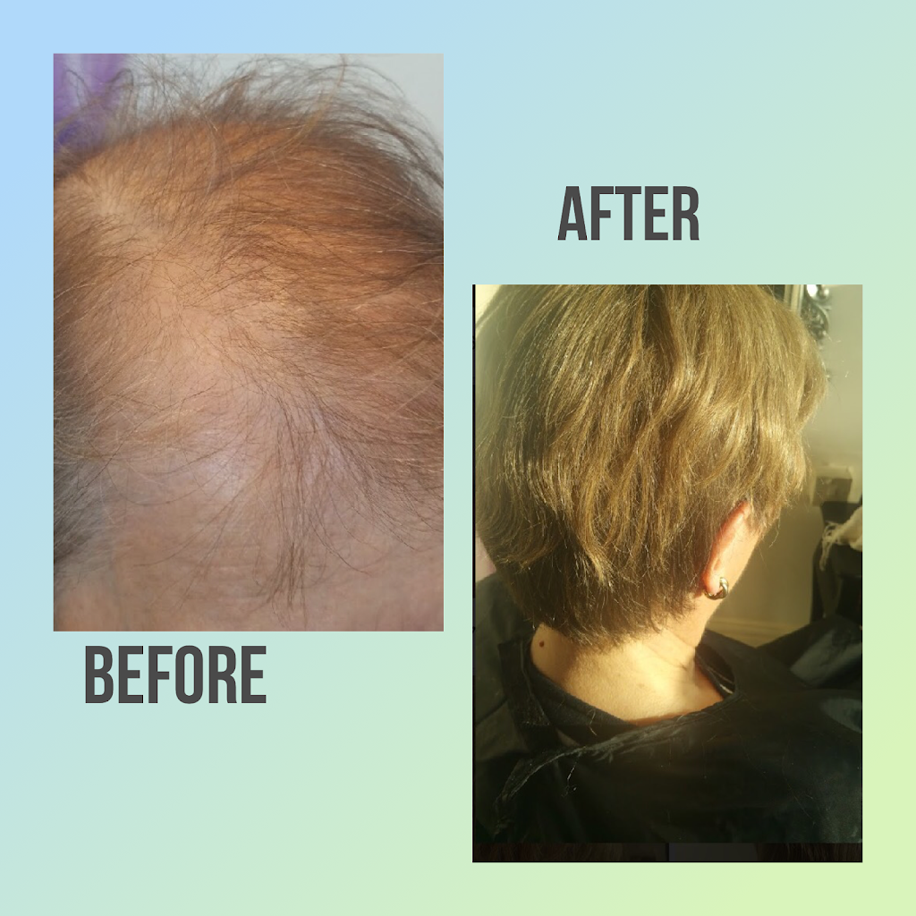 Ottawa Hair Loss Clinic & Wellness | 2888 St Joseph Blvd, Orléans, ON K1C 1G7, Canada | Phone: (613) 837-4656