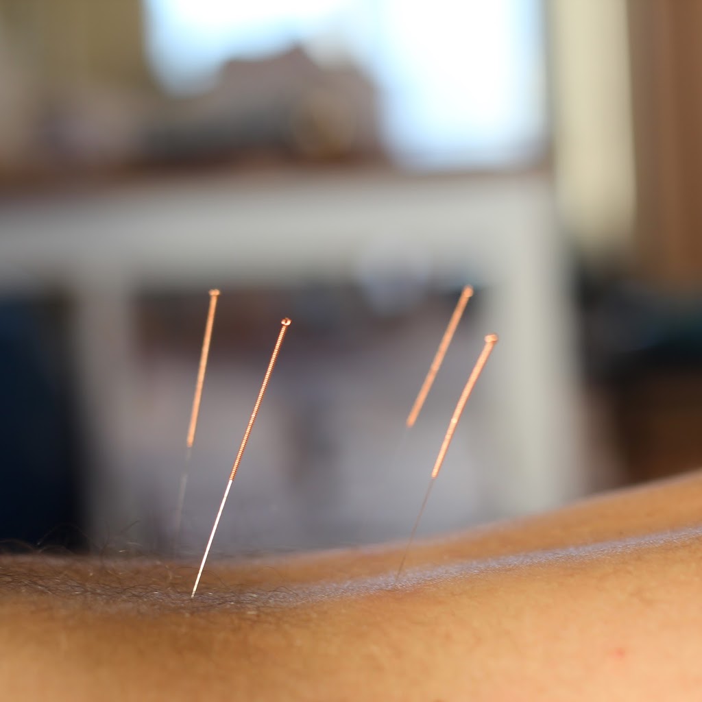 Silverado Sport Physiotherapy | 19369 Sheriff King St S, Calgary, AB T2X 0T9, Canada | Phone: (403) 474-8692
