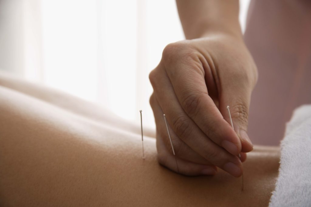 Janis Krause Acupuncture | 358 University Park Dr, Regina, SK S4V 0Y8, Canada | Phone: (306) 921-0084