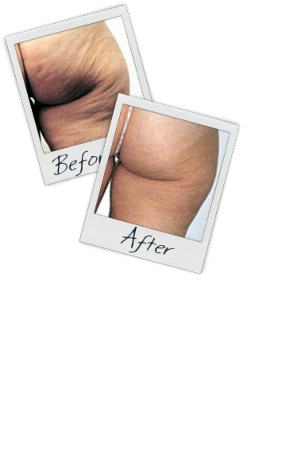 Beauté MédiSpa | 956 Rue des Monarques, Saint-Lazare, QC J7T 0K7, Canada | Phone: (514) 465-4645
