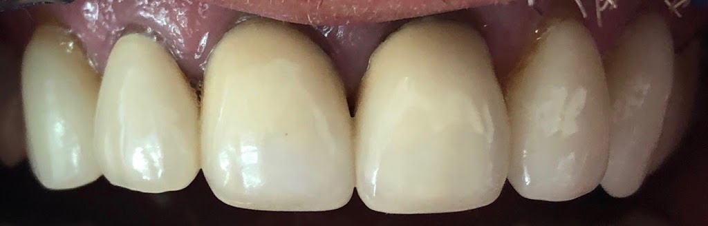 Corydon Dental Centre | 1425 Corydon Ave #201, Winnipeg, MB R3N 2C7, Canada | Phone: (204) 487-1744