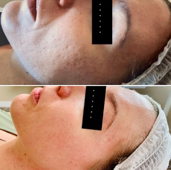 Jada Skin and Health Institute | 3030 Pandosy St #213, Kelowna, BC V1Y 0C4, Canada | Phone: (778) 581-7675