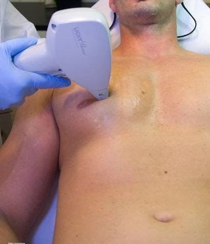 Pura laser | 681 Rue Adoncour, Longueuil, QC J4G 2M6, Canada | Phone: (514) 705-4923