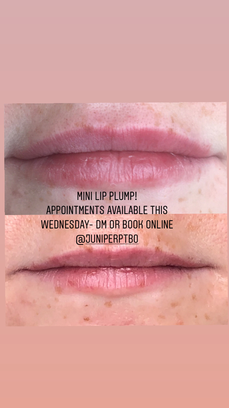 Lips and Lines by Lil | 380 Moloney Line, Ennismore, ON K0L 1T0, Canada | Phone: (705) 868-7529
