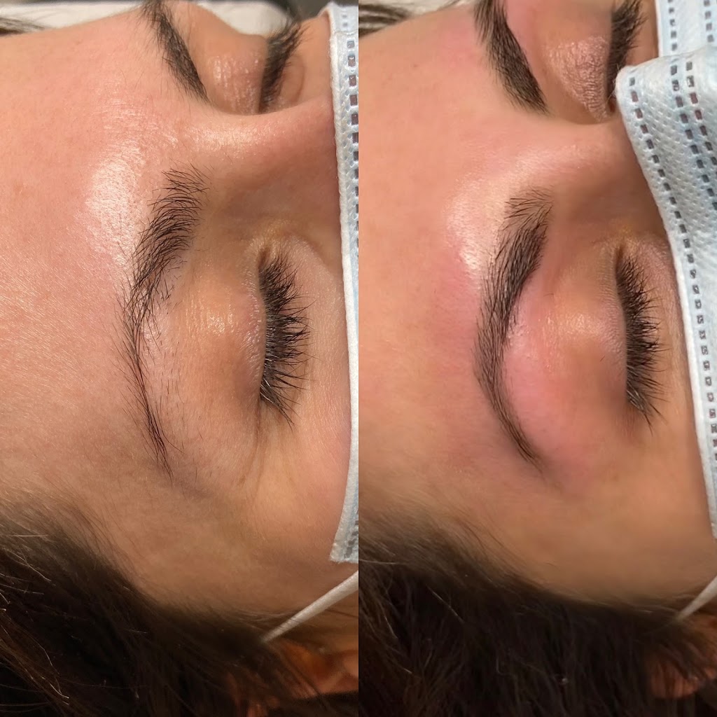 JJAesthetics | 164 Yellow Birch Dr, Kitchener, ON N2N 2N6, Canada | Phone: (519) 498-8601