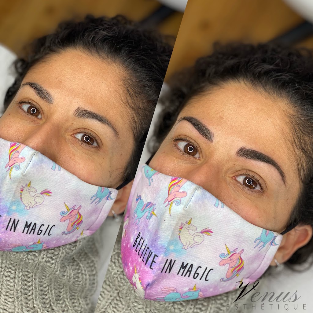 Venus - Esthétique | 505 Bd Sir-Wilfrid-Laurier, Beloeil, QC J3G 4H8, Canada | Phone: (514) 572-1236