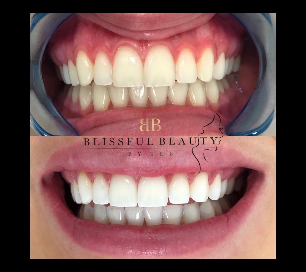 Blissful Beauty by Tee | health | 677 Rue Hauterive, Laval, QC H7G 4L8, Canada | 5147789387 OR +1 514-778-9387