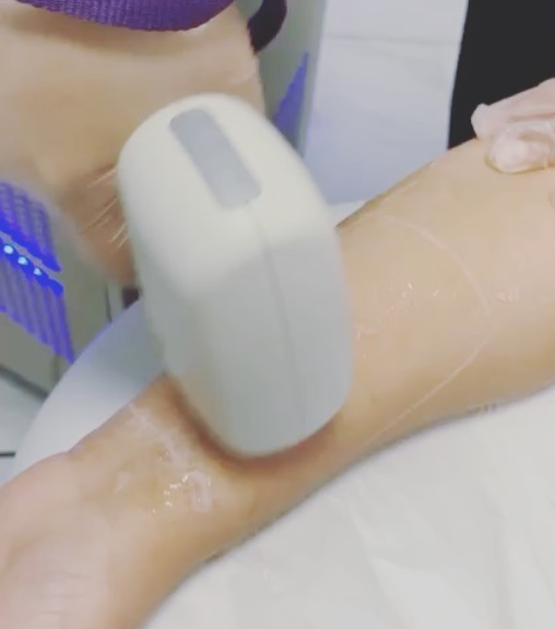 Skin Treats Laser & Med Spa | 12835 62 Ave, Surrey, BC V3X 3L9, Canada | Phone: (604) 771-7546