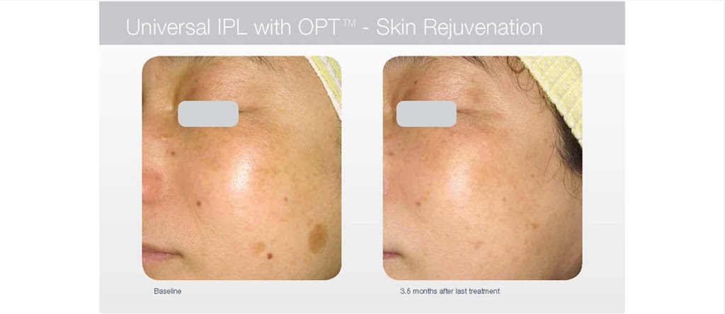 Beautique Laser Spa | 398 Steeles Ave W Unit #3, Thornhill, ON L4J 6X3, Canada | Phone: (416) 877-4348