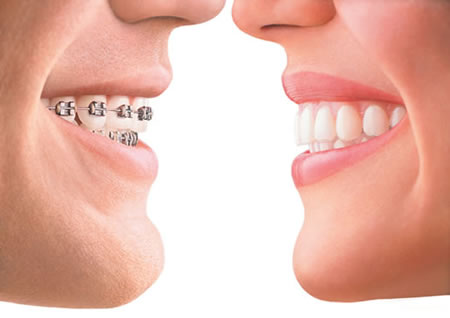 Dr Ross Fiore - Guelph Orthodontics | 320 Eramosa Rd, Guelph, ON N1E 2M8, Canada | Phone: (519) 780-1000