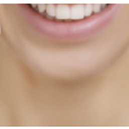 Artisan Dental | 510-777 Royal Oak Dr, Victoria, BC V8X 4V1, Canada | Phone: (250) 479-8100
