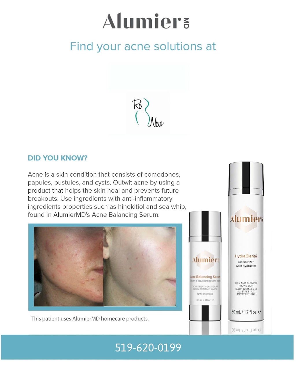 ReNew Medical Laser & Skin Care Aesthetics Inc. | 725 Coronation Blvd Unit B4, Cambridge, ON N1R 0B6, Canada | Phone: (519) 620-0199