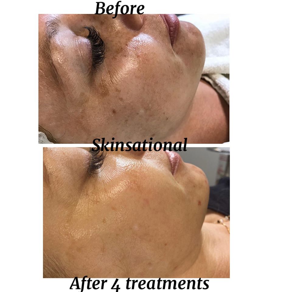 Skinsational | 10610 96a St, Morinville, AB T8R 0E8, Canada | Phone: (780) 619-3043