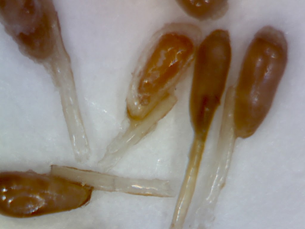 LICE911 Head Lice Removal Solutions | 20956 Tanner Pl, Maple Ridge, BC V2X 8J1, Canada | Phone: (778) 879-7805