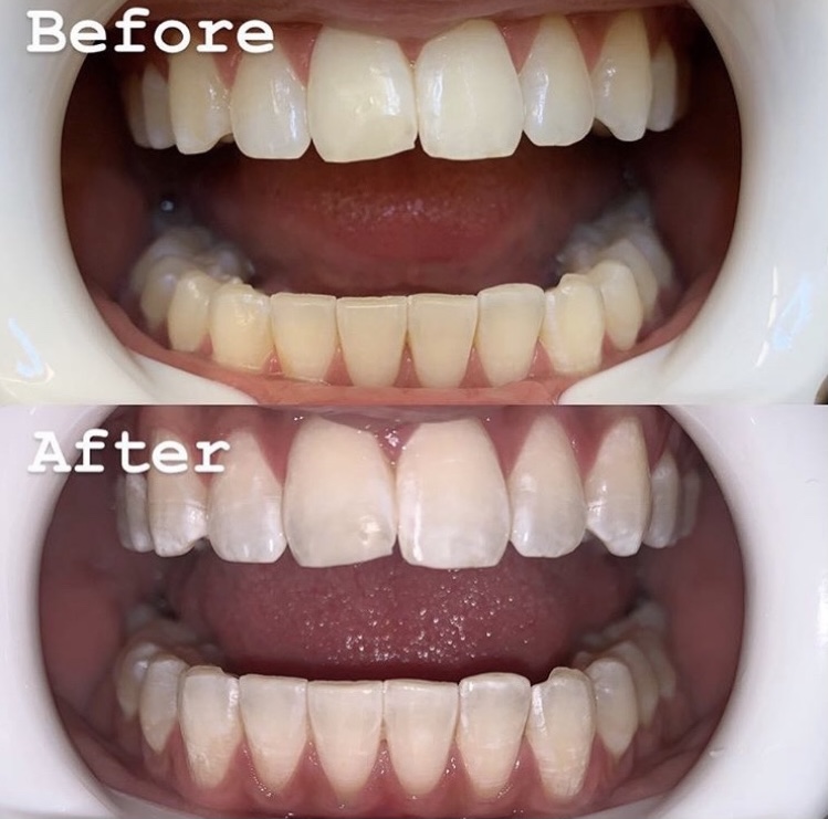 Pearly Whites by Simona | Hwy 7, Weston Rd, Vaughan, ON L4L 9H1, Canada | Phone: (416) 830-6966