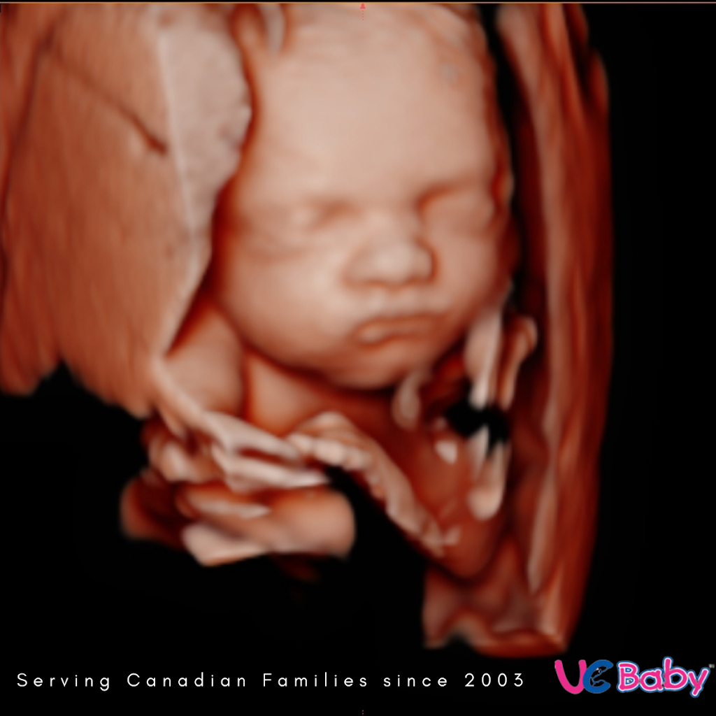 UC Baby 3D Ultrasound | 140 Champlain St #102B, Dieppe, NB E1A 1N8, Canada | Phone: (506) 388-3333