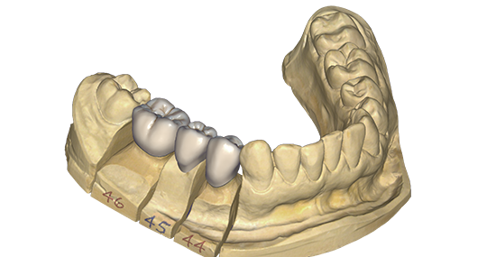 Dental Axess North America | 700 Third Line, Oakville, ON L6L 4B1, Canada | Phone: (855) 877-8200