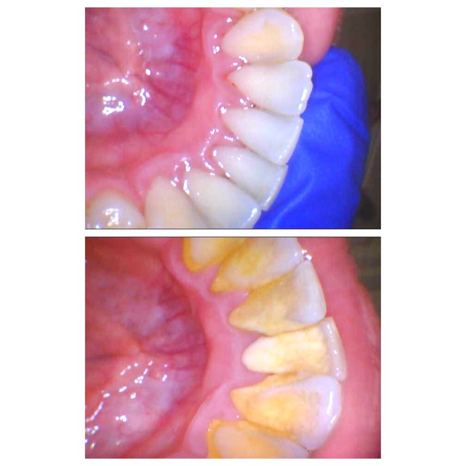 Nordic Dentistry | 465 Highland Rd W #3, Kitchener, ON N2M 3C6, Canada | Phone: (519) 208-4060