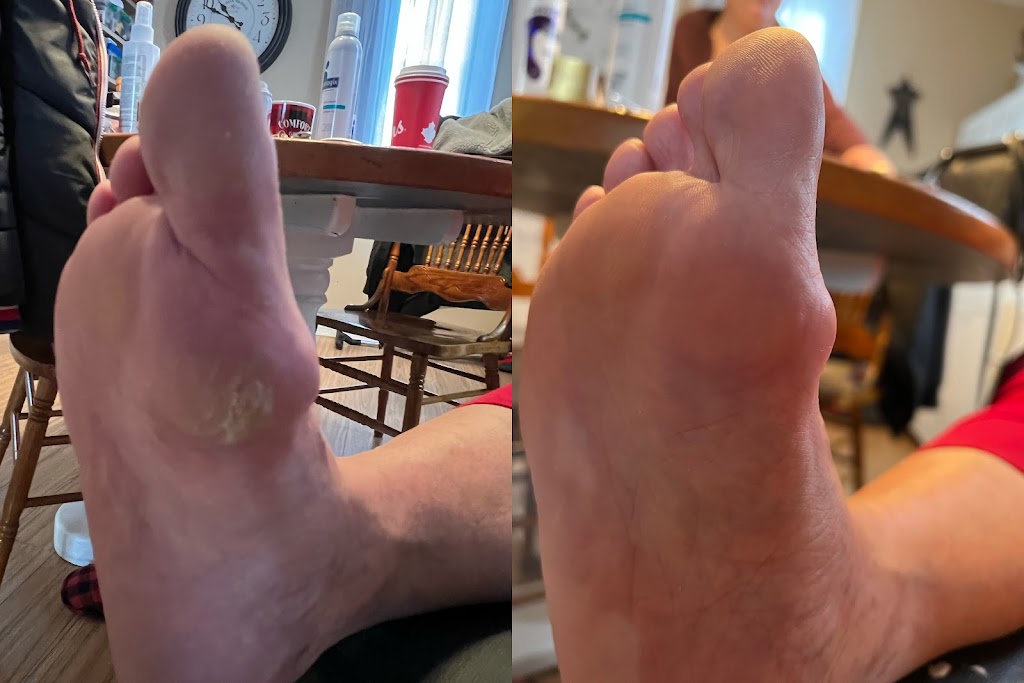 Highlands Foot Care | Young St, Maynooth, ON K0L 2S0, Canada | Phone: (519) 580-7121